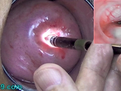 Wife Cervix Playing with Endoscope Japanese Cam into Uterus