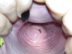 'Cervix close up [4k]'