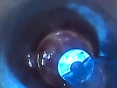 test tube cock endoscope POV urethral insertion ball rod